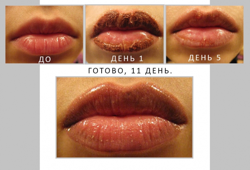 Что такое перманентный макияж губ. Как его готовят и сколько времени держится. Какие бывают техники перманентного макияжа. Исцеление, исцеление, коррекция и удаление.