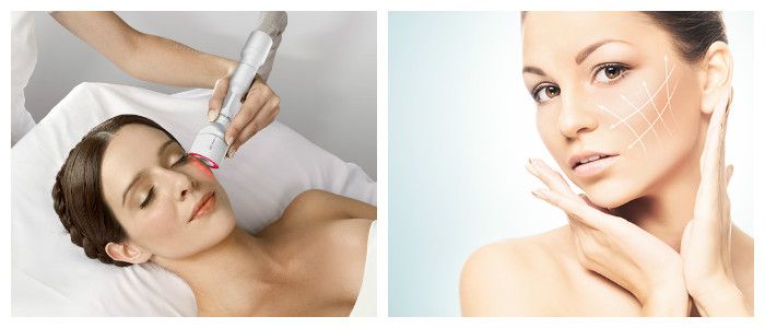 Биоревитализация - безопасный способ восстановления кожи гиалуроновой кислотой